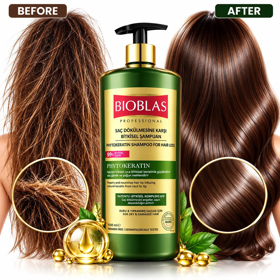 BIOBLAS SHAMPOO 1000ML ANTI HAIR LOSS PHYTOKERATIN